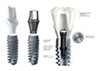 Premium Single Tooth Dental Implant
